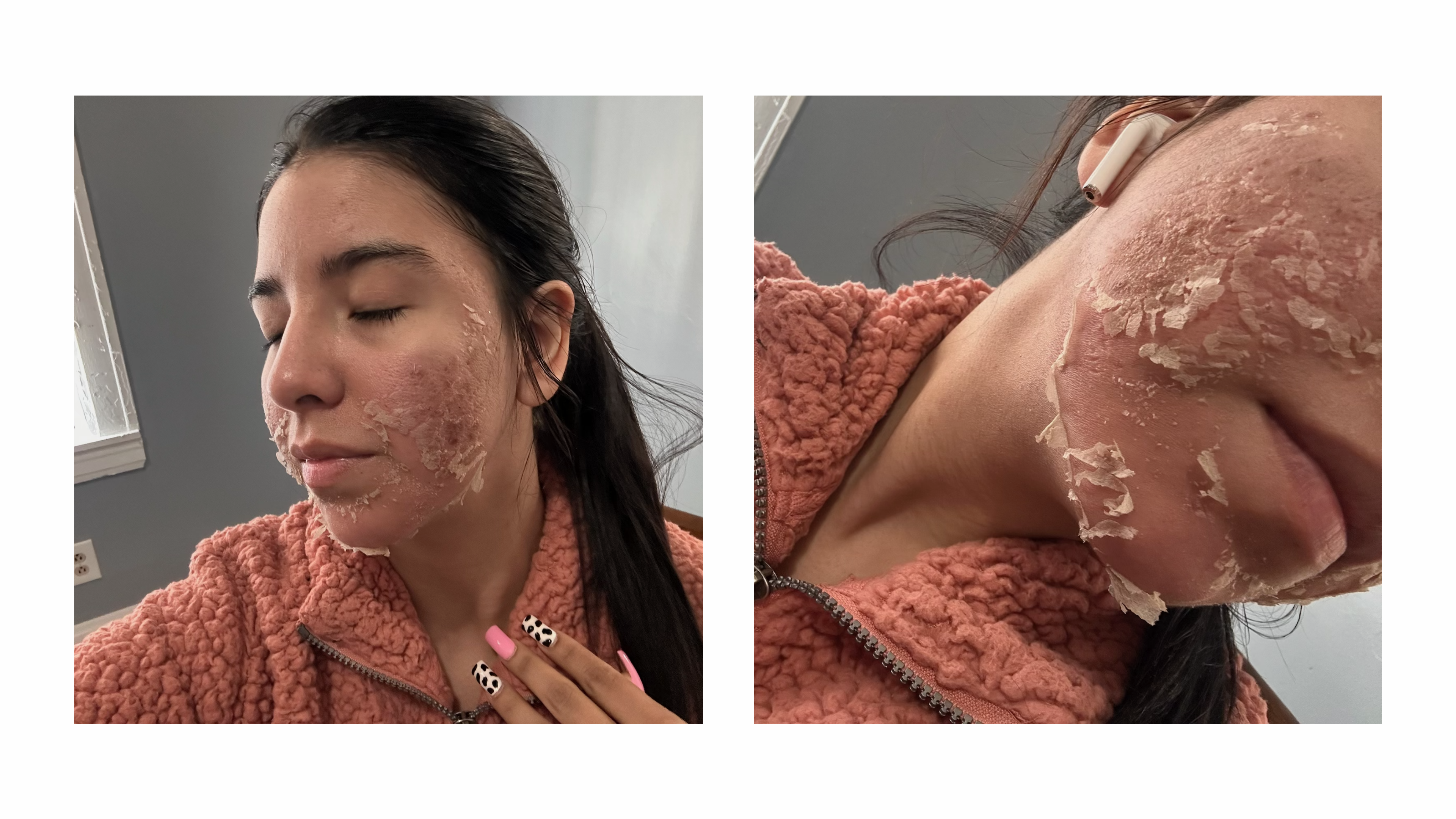 Zena cosmetics algae peel transformation offered by licensed esthetician at the SkinByMiso Med Spa and Salon facility in Dearborn, Michigan